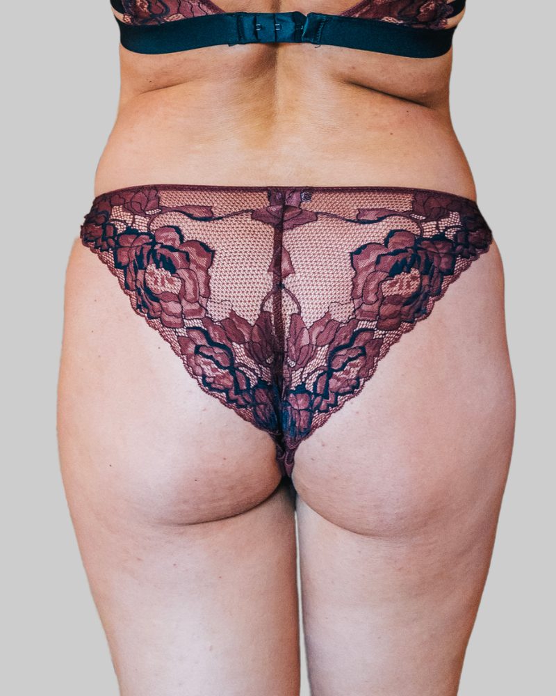 The Venus Strappy Cheeky Bikini